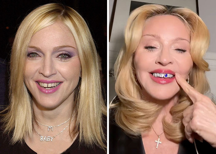 Celebridad rubia mostrando peculiaridades únicas en su estilo y sonrisa con confianza en dos fotos comparativas.