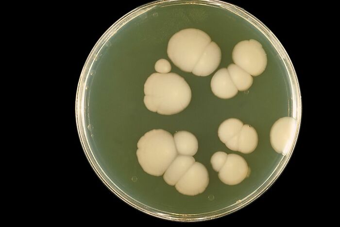 Petri dish with unusual bacterial colonies resembling abstract shapes, symbolizing weird baby names reactions.