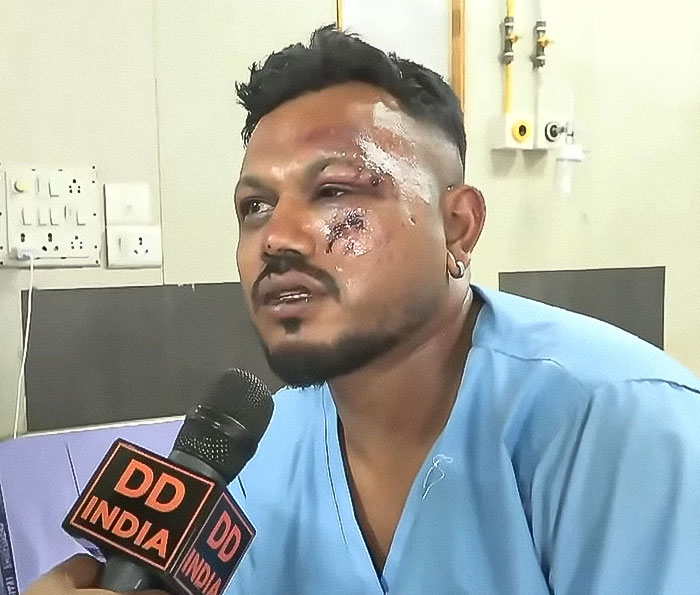 Survivor of Air India crash with facial injuries, wearing blue hospital gown, giving interview to DD India reporter.