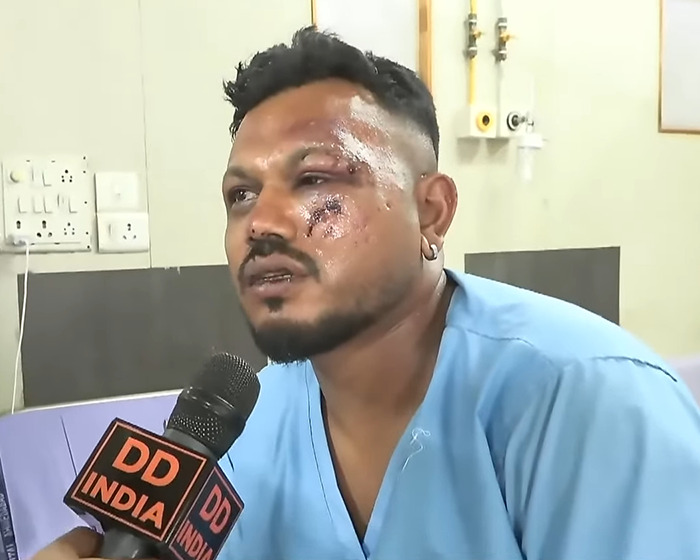 Injured man in blue hospital gown speaking to DD India reporter about Air India plane crash investigation.