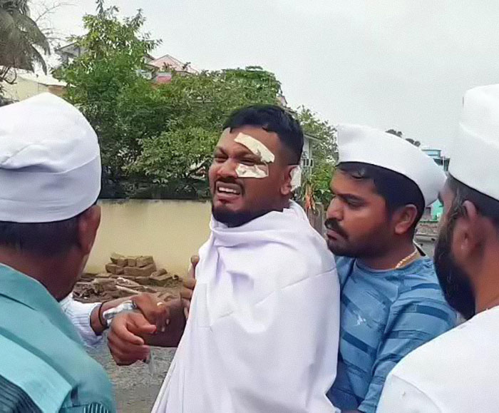 Man with bandages on face, visibly distressed, supported by others outdoors in a moment showing Air India survivor's guilt.