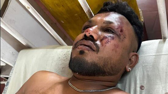 "A Nation In Shock": Plane Headed For London Crashes In Residential Area With 242 Onboard