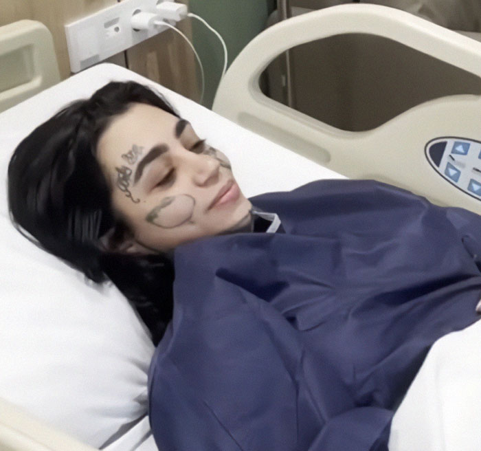 Young woman with facial tattoos resting in hospital bed after plastic surgery, highlighting risks of surgery and partying the night before.