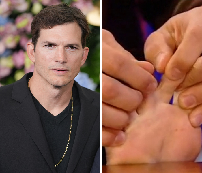 Actor with a unique hand anomaly, showcasing one finger bending unusually, highlighting bizarre celebrity body anomalies.