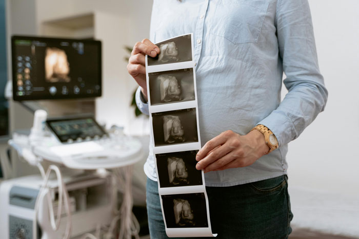 Pregnant woman holding ultrasound images in a clinic, highlighting concerns about baby&rsquo;s gender and family conflict.