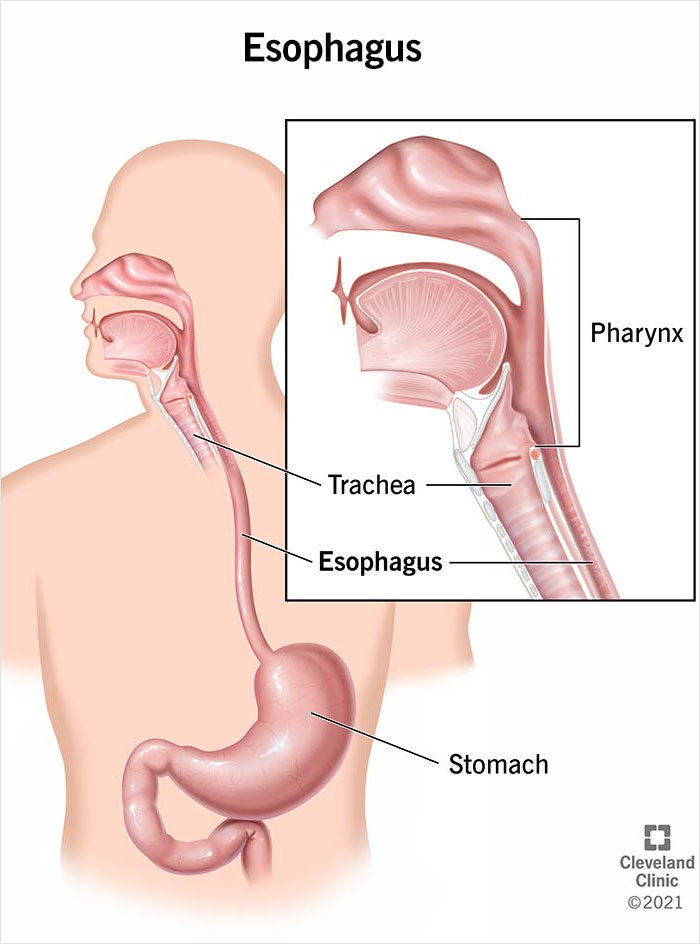 Detailed anatomical illustration of the esophagus, trachea, pharynx, and stomach highlighting human body flaws.