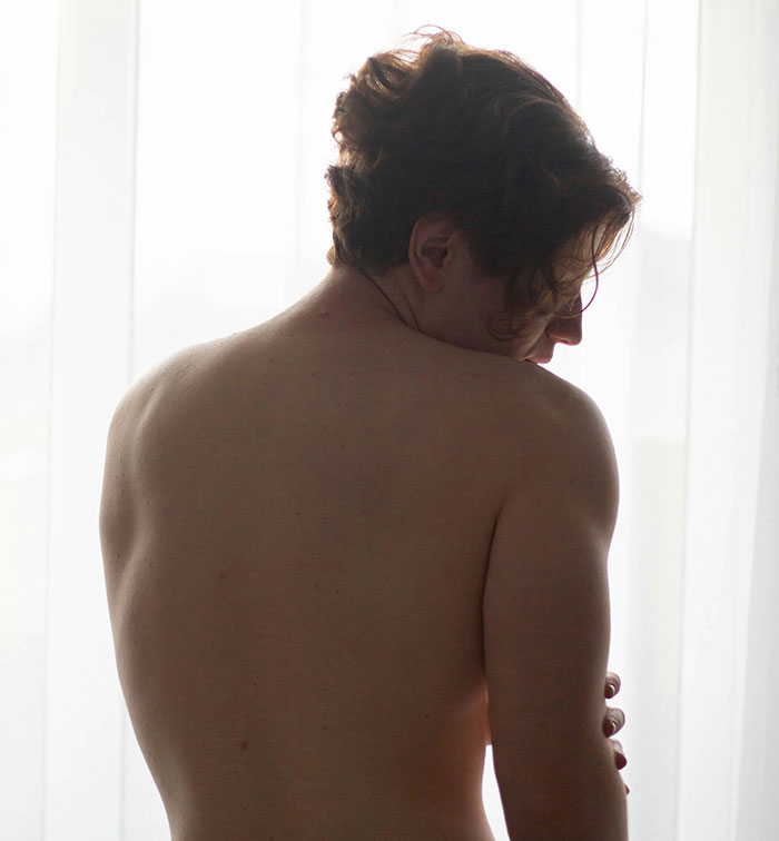 Young man showing flaws of the human body with a bare back against a bright window in natural light