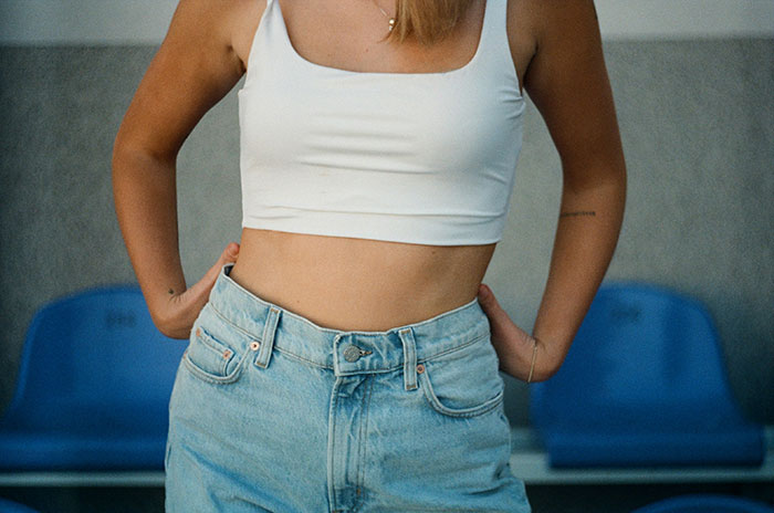 Young woman showing her midriff and wearing casual clothes, illustrating common flaws of the human body.