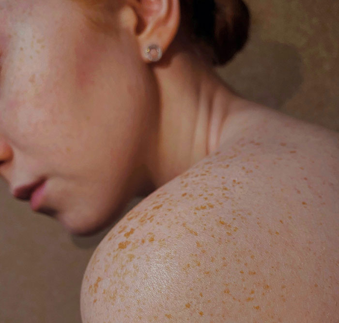 Nobody's Perfect But These 48 Human Body Flaws Are Just Stupid