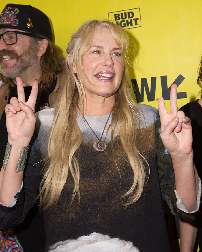 Celebrity smiling and showing peace signs at an event, highlighting celebrities with body abnormalities in the spotlight.