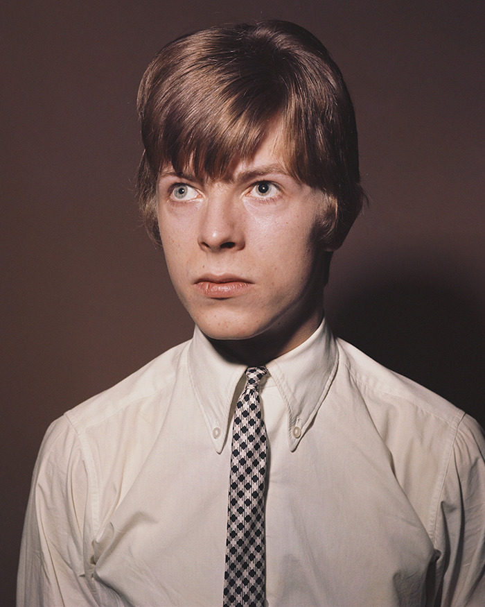 Young male celebrity posing against a brown background, dressed in a white shirt and patterned tie, showcasing body abnormalities.