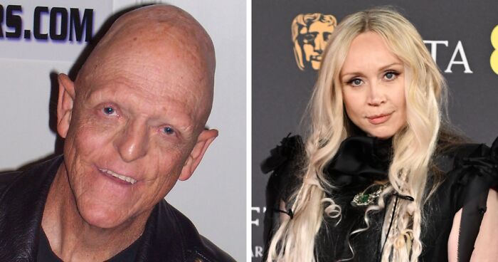 25 Celebs Who Embrace Their Gloriously Unique Quirks