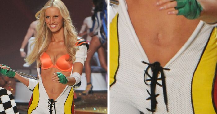 20 Bizarre Celebrity Body Anomalies That Left Fans Speechless