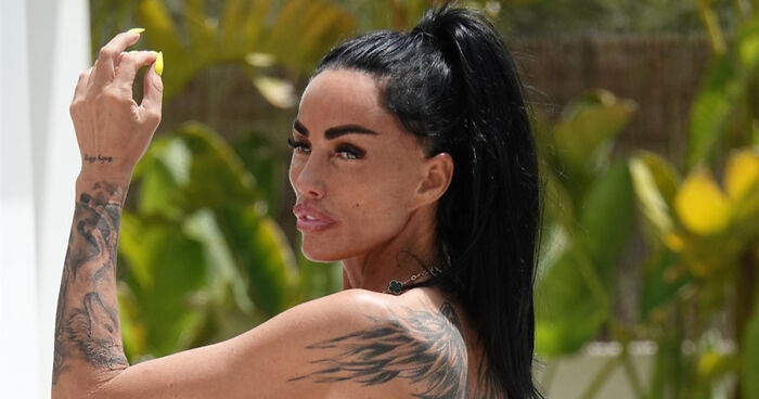 “Is Her Butt Leaking?:” Katie Price Flaunts Results Of Her “Painful” BBL Surgery During Holiday