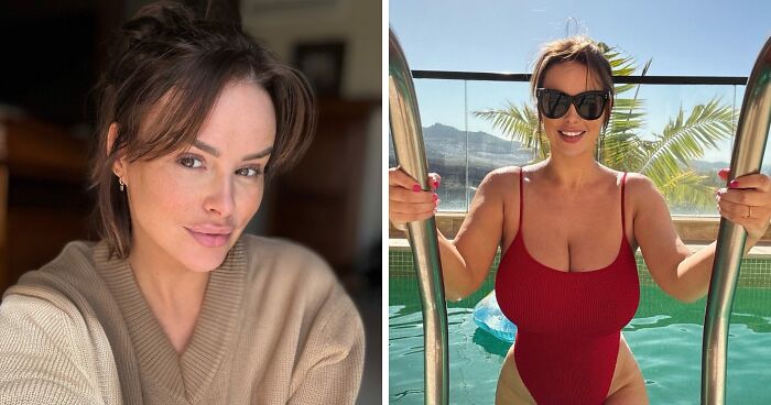 Model With F-Cup Chest Undergoes Breast Reduction Surgery After Walking Became “Unbearable”