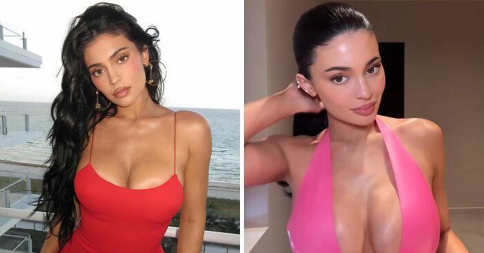 “They Are Way Too Big For Her Frame”: Kylie Jenner Nearly Spills Out Of Top After Breast Job Confession