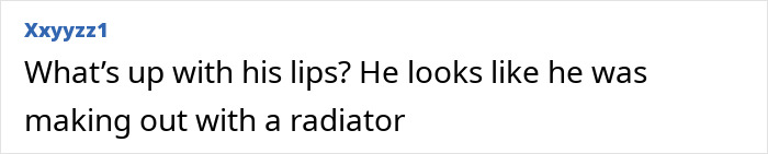 Kevin Spacey at red carpet event sparking plastic surgery rumors after receiving award, close-up of his facial appearance.