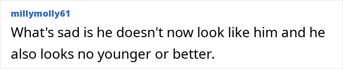 Kevin Spacey at a red carpet event, fueling plastic surgery rumors after his recent award appearance.