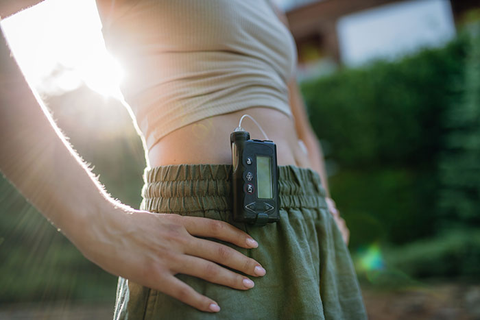 Close-up of woman wearing insulin pump on waist, prioritizing health over sister&rsquo;s wedding photo aesthetic concerns.