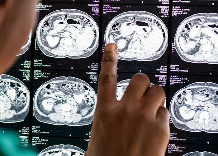 Doctor examining detailed medical scans on a screen, highlighting surprising medical conditions diagnosed.
