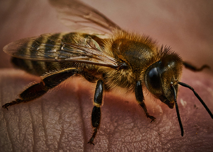 Close-up of a bee resting on human skin, illustrating bizarre medical cases involving unusual skin conditions.