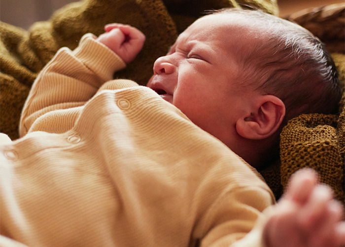 Newborn baby lying on a blanket, illustrating surprising medical conditions affecting infants and newborn health concerns.