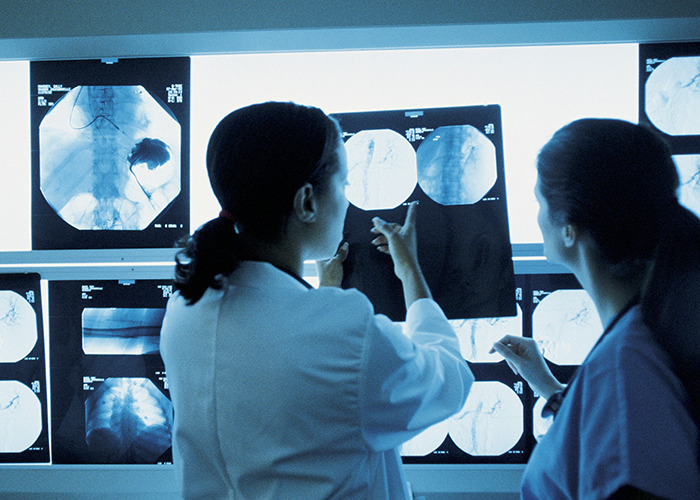 Two medical professionals examining x-rays and discussing rare medical conditions that surprised doctors in a clinical setting