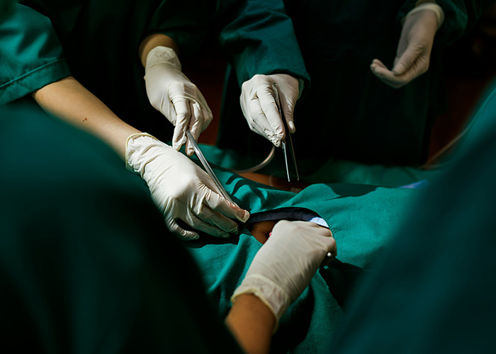 Surgeons wearing gloves performing a medical procedure in an operating room for rare medical conditions.