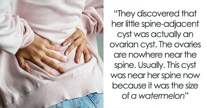 “Her Skin Was Everywhere”: 40 People Share The Most Bizarre Medical Cases They Witnessed
