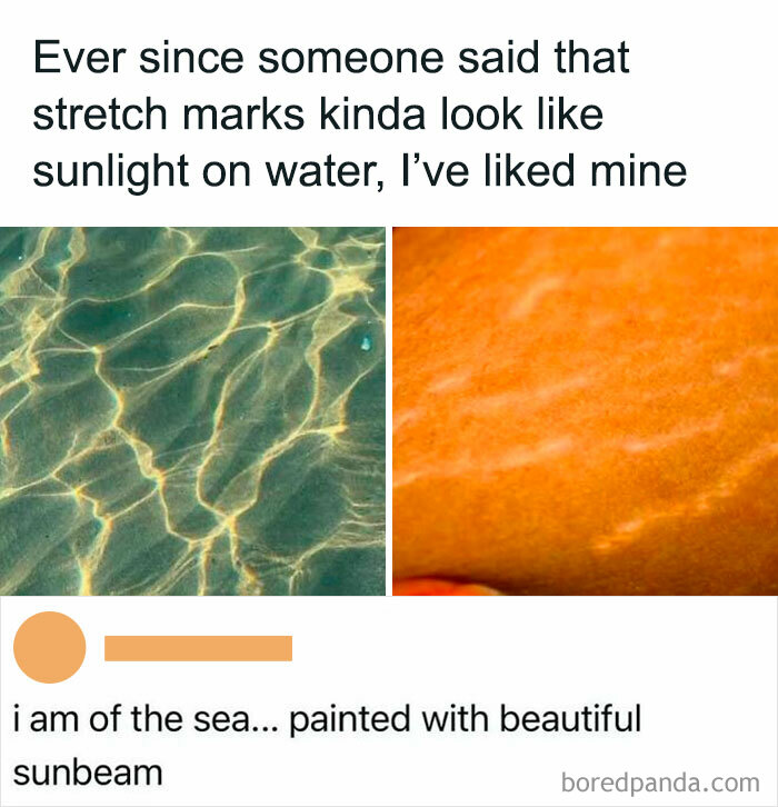 Comparison of sunlight reflections on water and stretch marks on skin, highlighting relatable posts about self-acceptance and beauty.
