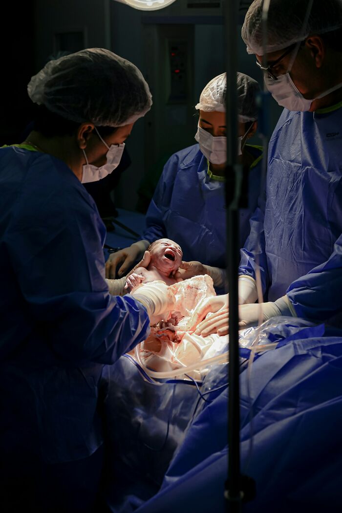 Medical team delivering newborn baby during childbirth in a surgical room, focusing on pregnancy and postpartum care.
