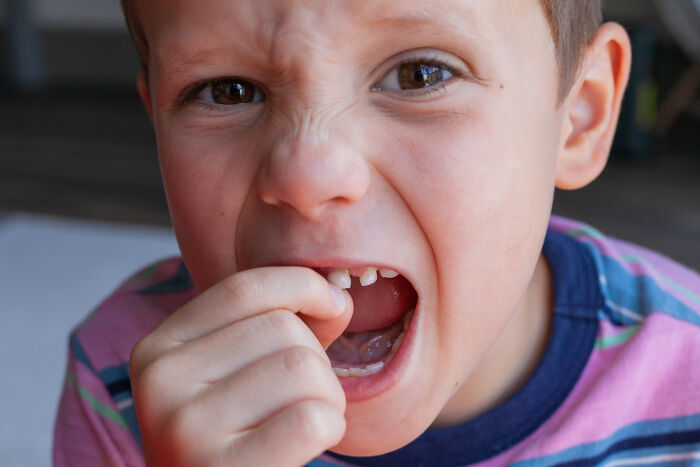 Close-up of a young child struggling with a loose tooth, illustrating the nose-diving abilities of younger generations.