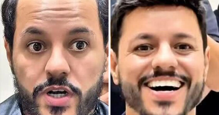 These 40 Men Got Non Surgical Hair Makeovers, And The Results Are Shockingly Natural Looking