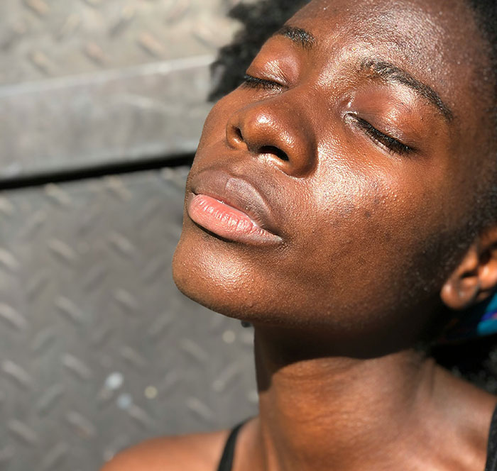Close-up of a woman with glowing skin basking in sunlight, illustrating health and wellness concepts about fat.