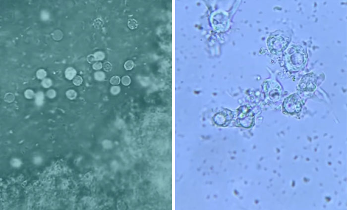 Microscopic images showing detailed views of tiny cells and particles with a blue and green background.