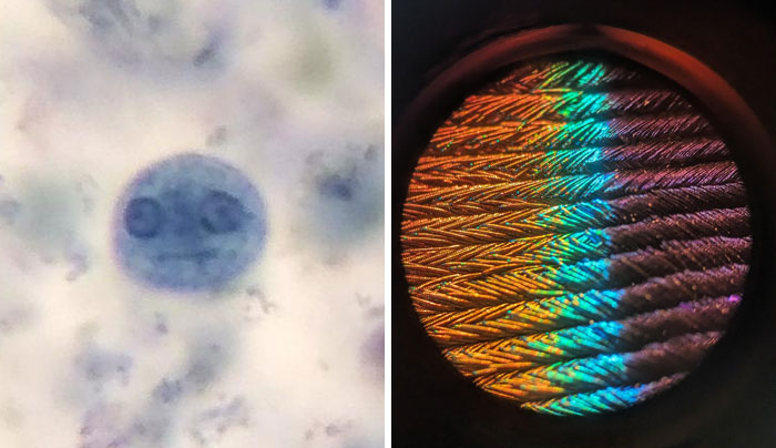 People Who Have A Microscope Share The Most Interesting Things They Observed Up Close (New Pics)