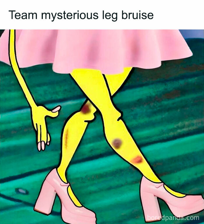Cartoon character with yellow legs and pink shoes showing mysterious leg bruises in a cute and wholesome post.