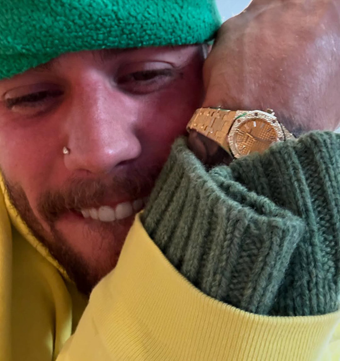 Justin Bieber wearing a green beanie and yellow jacket, showing a gold watch after paparazzi meltdown concerns. Justin Bieber wearing a green beanie and yellow jacket, showing a gold watch after paparazzi meltdown concerns.
