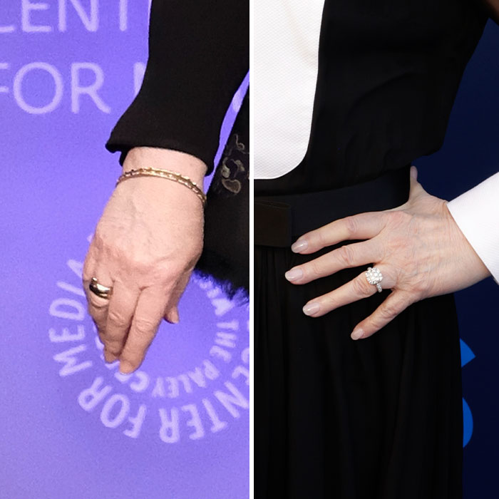 “Ozempic Hands” Is The Latest Skinny Side Effect No One Asked For: “Excuse Me While I Throw Up”