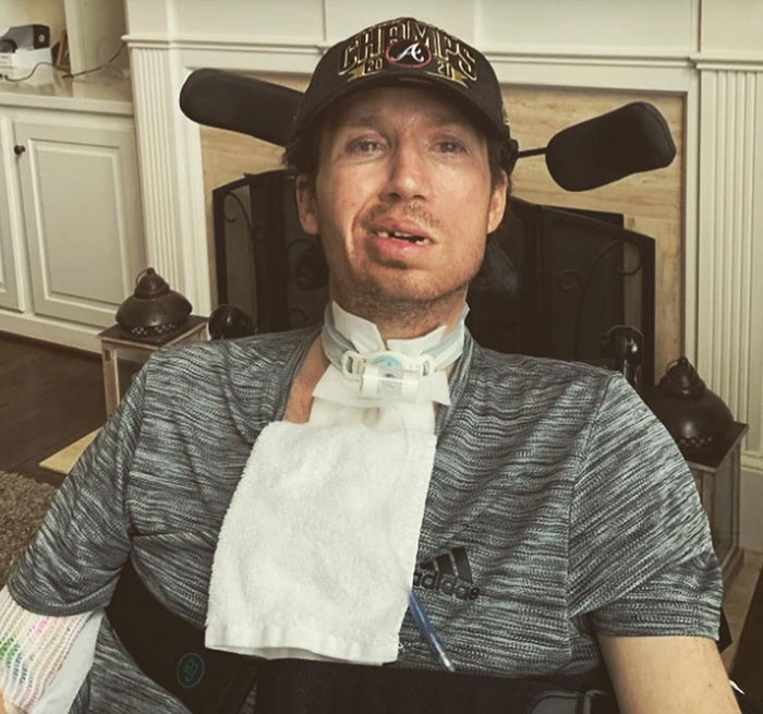 Man with locked-in syndrome sitting in a wheelchair after visiting a chiropractor for neck pain treatment at home.