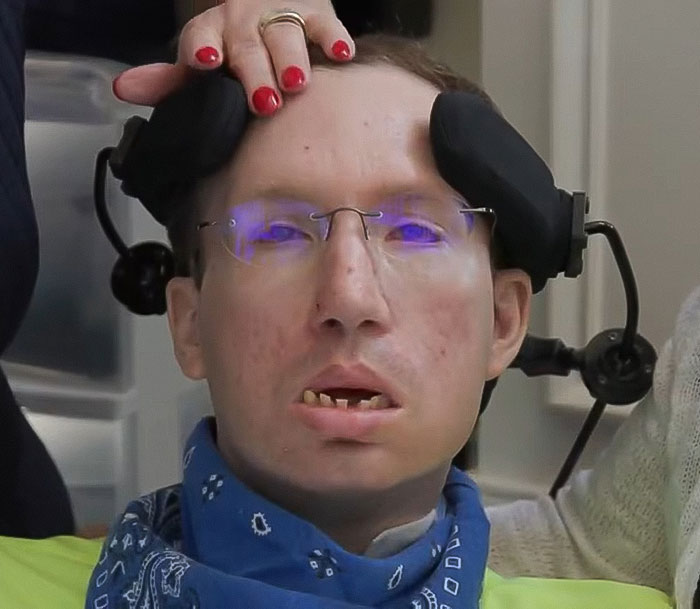 Man with locked-in syndrome sitting in a chair, wearing glasses and a blue bandana, assisted by a caregiver.