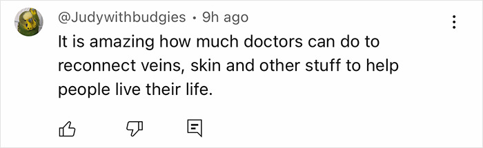 A tweet praising doctors for reconnecting veins and skin to help a man with a new face transplanted from a 47-year-old donor. A tweet praising doctors for reconnecting veins and skin to help a man with a new face transplanted from a 47-year-old donor.