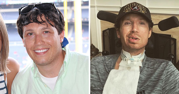 Man Who Went To Get His Neck Pain Fixed Now Wants Family To ‘Pull The Plug’