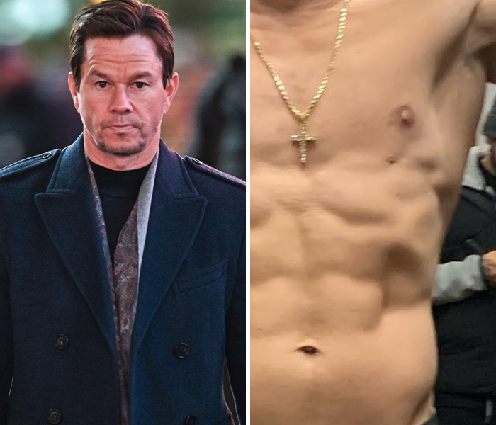 Actor Mark Wahlberg walking outside in a dark coat next to a close-up of a celebrity’s unusual body anomaly.