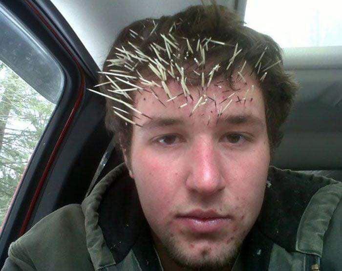 Young man with porcupine quills stuck in his forehead sitting inside a vehicle, illustrating men doing dumb things.