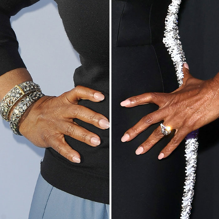 “Ozempic Hands” Is The Latest Skinny Side Effect No One Asked For: “Excuse Me While I Throw Up”