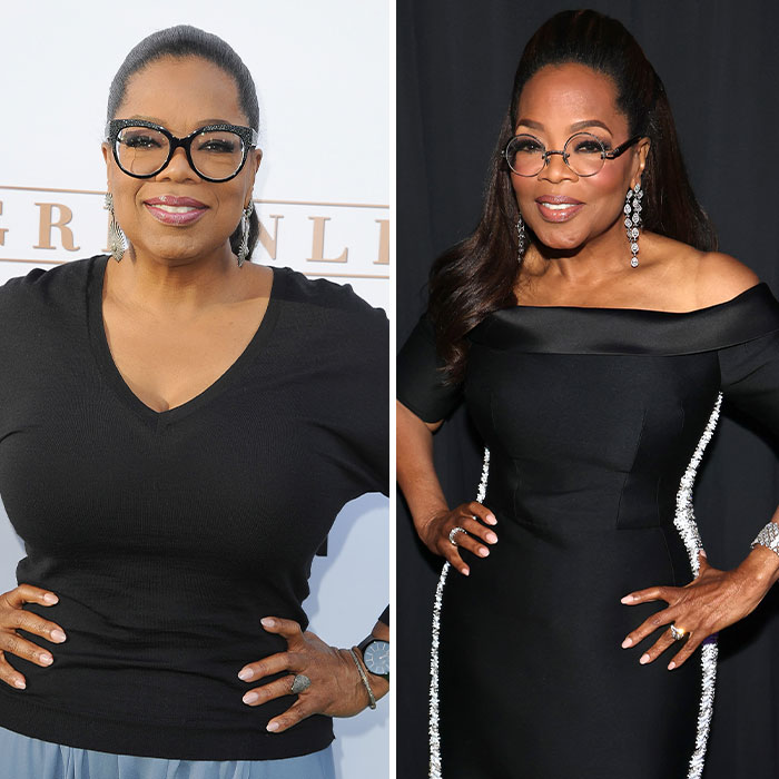 “Ozempic Hands” Is The Latest Skinny Side Effect No One Asked For: “Excuse Me While I Throw Up”