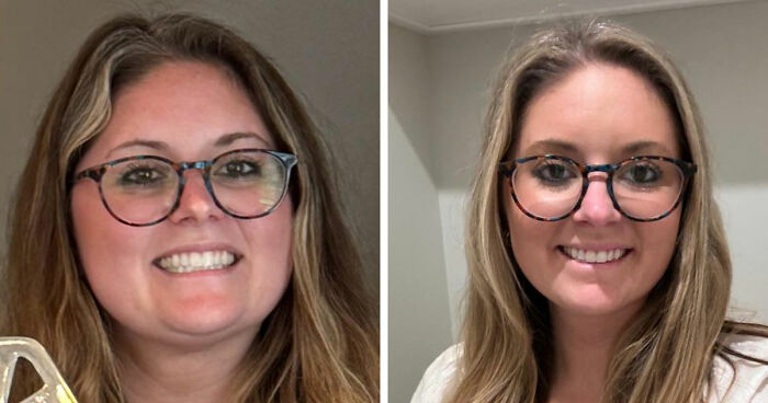 Before and after photos showing major weight loss transformation of a smiling woman wearing glasses indoors.