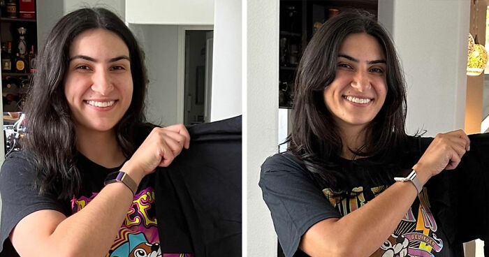 Side-by-side before and after weight loss photos of a smiling woman showing major transformation using Ozempic.