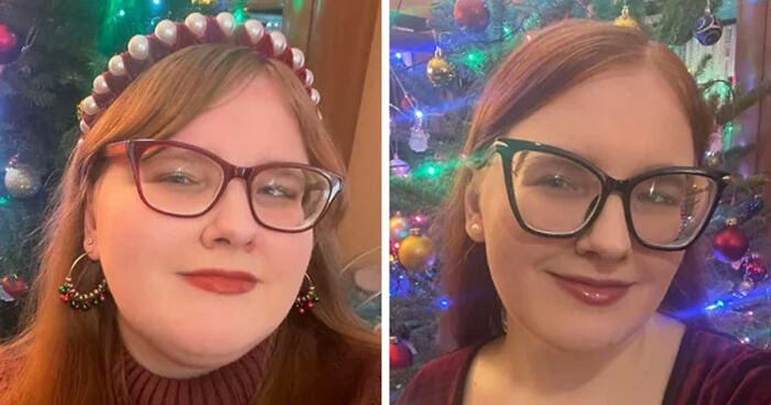 Side-by-side weight loss before and after photos of a woman showing major transformation with Ozempic results.